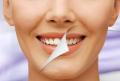 Отбеливание зубов в СПБ по самым привлекательным ценам